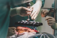 Chirurgové českobudějovické nemocnice operovali inovativní metodou Fasciotens